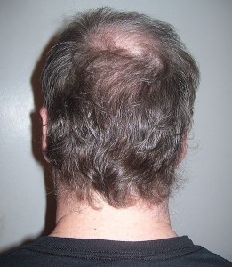 photo showing back of a man's head
